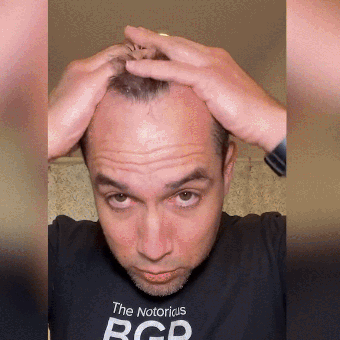 بخاخ نمو الشعر Amarah-FEG - حل طبيعي لإعادة نمو الشعر وتقويته