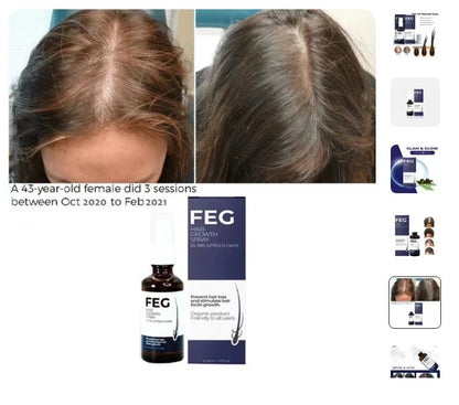 Amarah-FEG Hair Growth Spray-Natural Hair Regrowth & Strengthening Solution